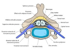 neck pain