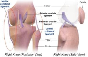 collateral ligament injury of the knee