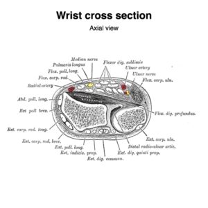 Carpal Tunnel Syndrome