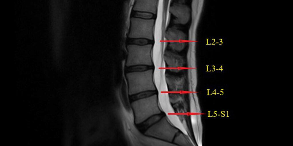 lower back hip pain right side treatment