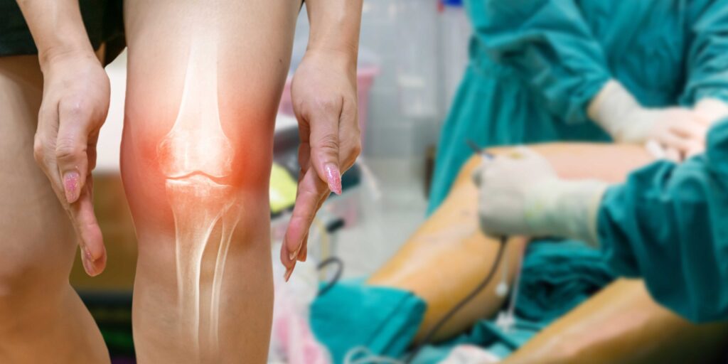best treatment for knee arthritis pain