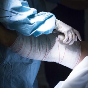 Knee Arthroplasty