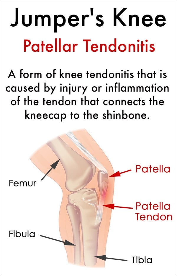 knee pain specialist in Singapore