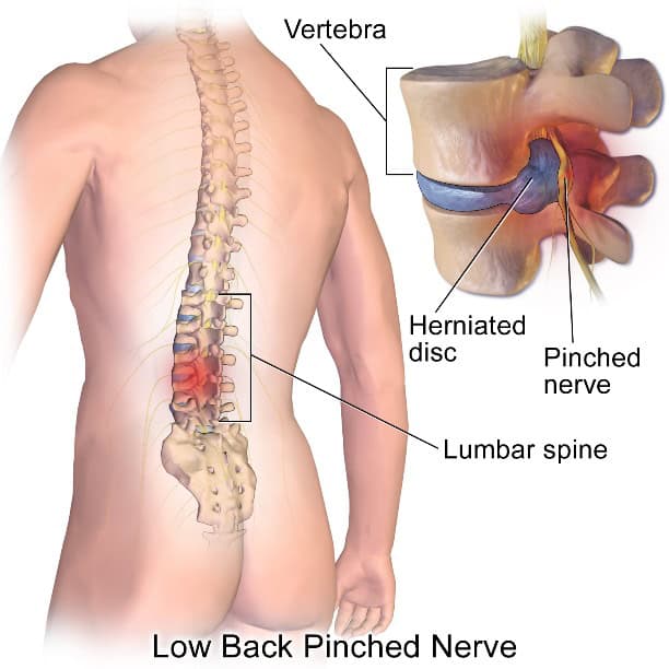 lower back pain after standing too long