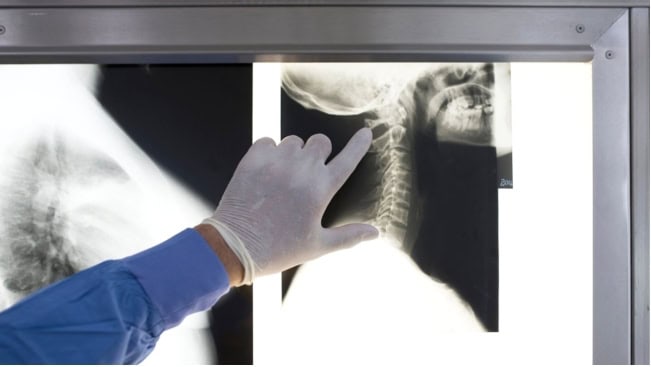 neck pain symptoms and treatment